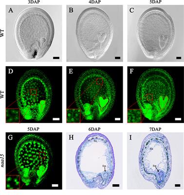 Transcriptome characteristics during cell wall formation of endosperm cellularization and embryo differentiation in Arabidopsis